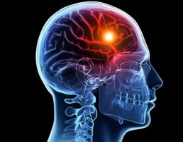 A Celle di Bulgheria visite gratuite per la prevenzione degli ictus ischemici